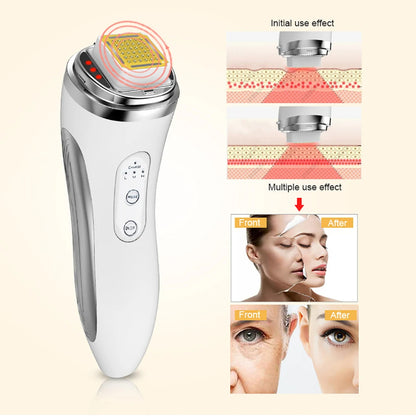 Radio Frequency Facial Lifting Massager