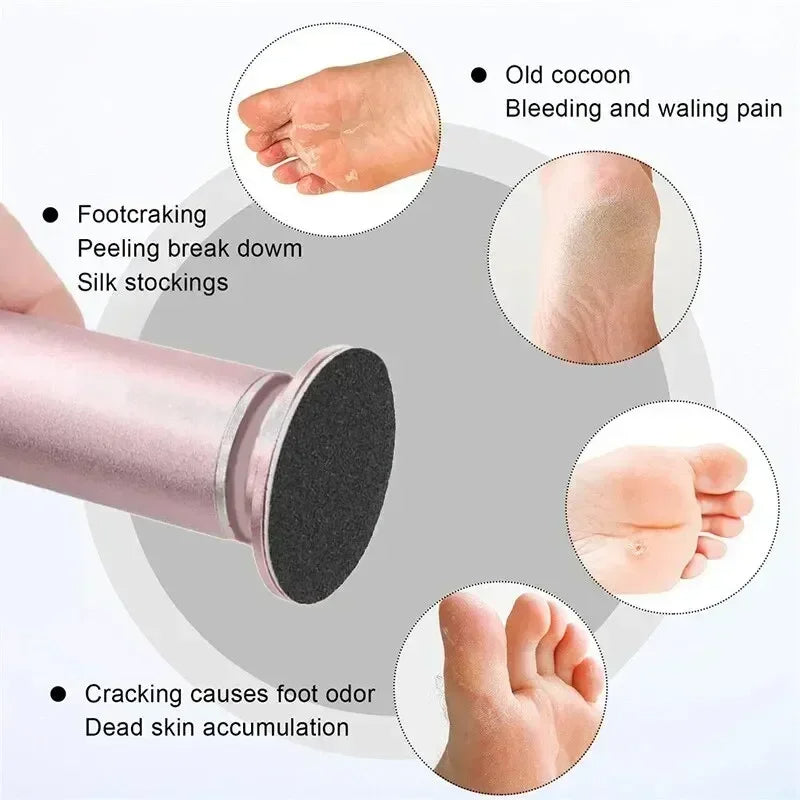 Electric Foot Callus Remover